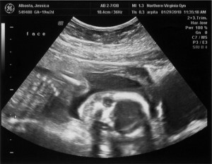 Baby Albosta at 19 weeks, 2 days.